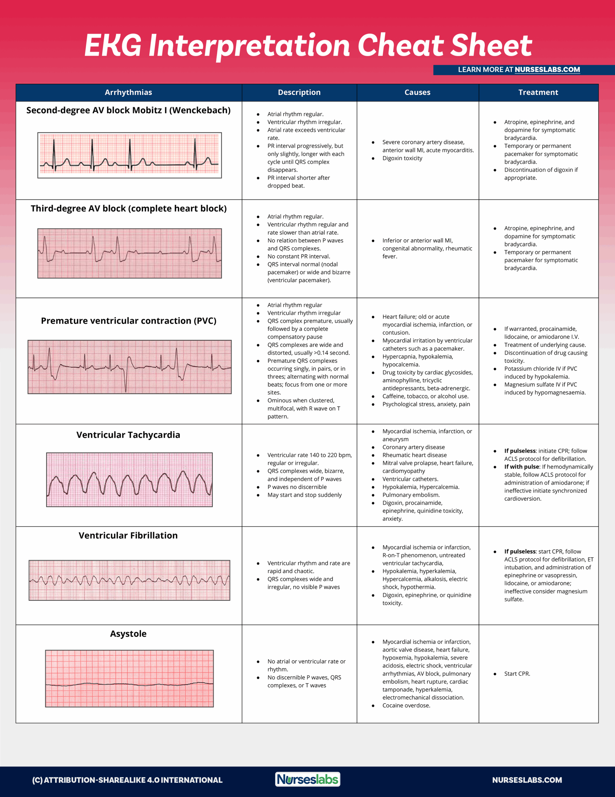 EKG Interpretation Cheat Sheet U0026 Heart Arrhythmias Guide 2020 